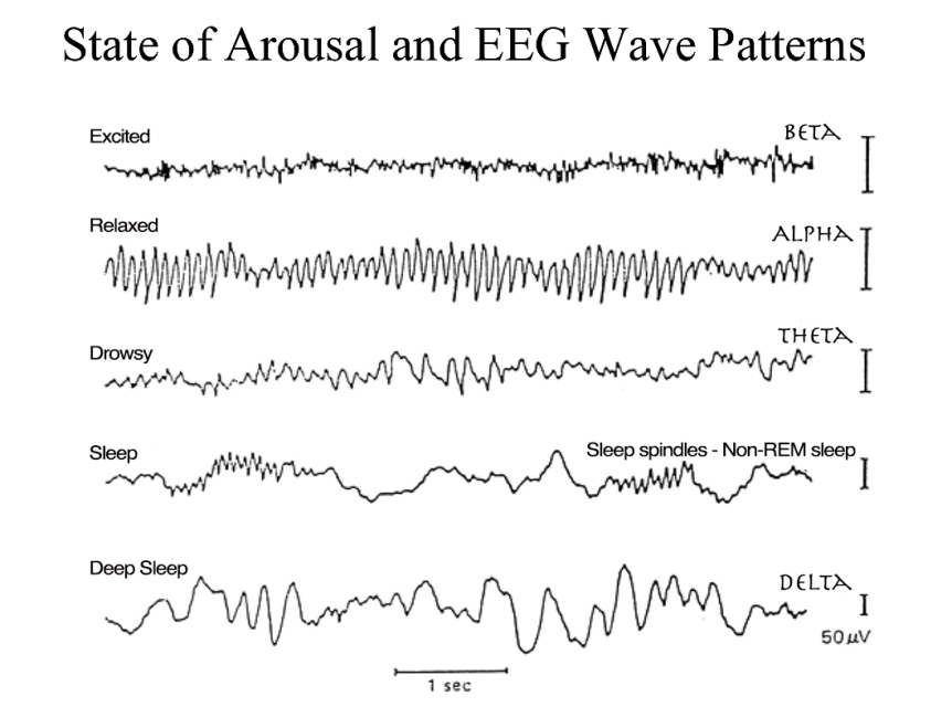 EEG patterns
